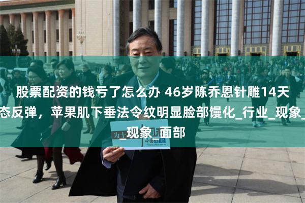 股票配资的钱亏了怎么办 46岁陈乔恩针雕14天后状态反弹，苹果肌下垂法令纹明显脸部馒化_行业_现象_面部